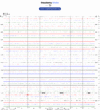 Helicorder image archive
