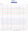 Helicorder image archive